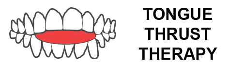 Tongue Thrust Therapy